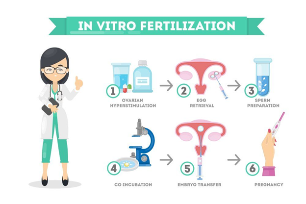 In Vitro Fertilization Process.
